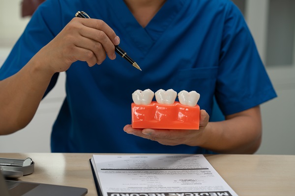 Tips For Taking Care Of Your Dental Crowns